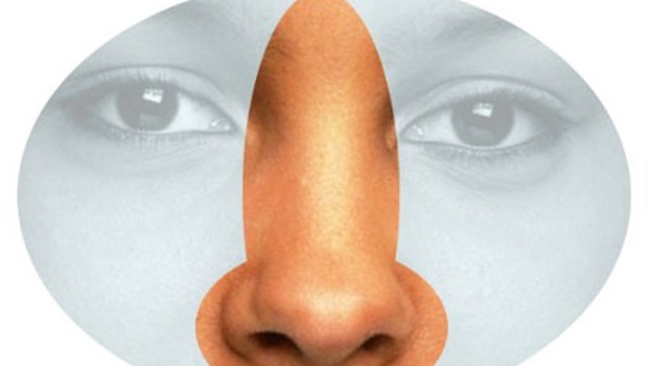 حساسية الأنف 